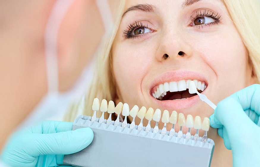 dental implants