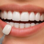 Dental Implants Newport Beach